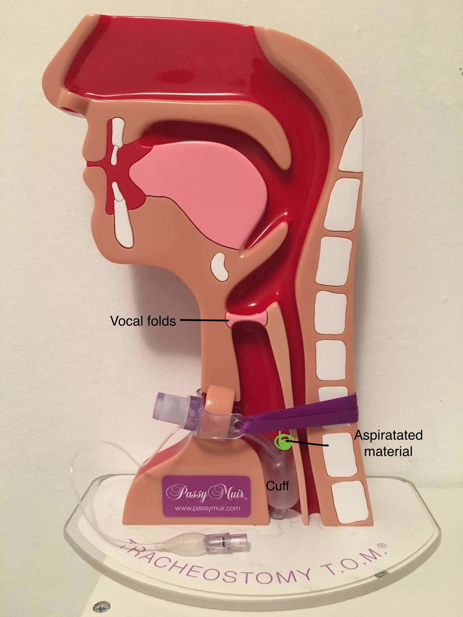 aspiration trach image scaled